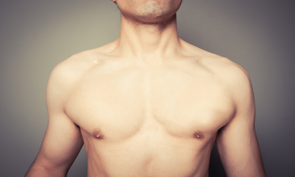 tumore al seno negli uomini: cause, sintomi e prevenzione 